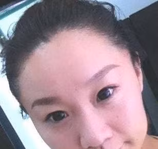 Nhung not ruoi nay tot nhat nen tay di de tranh xui xeo-Hinh-4