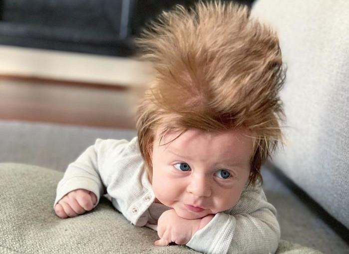 Be 4 thang tuoi co mai toc 