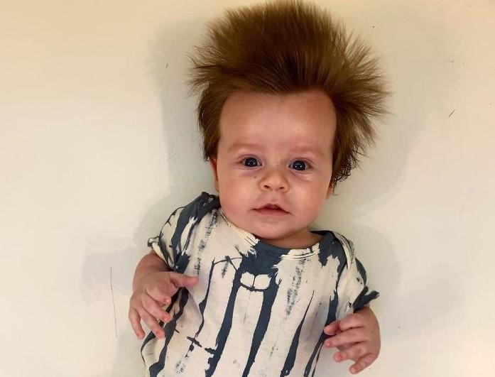 Be 4 thang tuoi co mai toc 