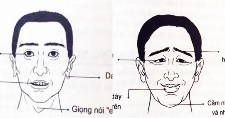  Mỏ nhọn, môi mỏng. Đàn ông mỏ nhọn, môi mỏng thường là người hay “chém gió”, ăn nói lươn lẹo, không thành thật. Gặp bất kể ai họ cũng dễ dàng làm quen, bắt chuyện. Họ tán gái giỏi, nhắm vào ai thì người đó khó thoát khỏi lưới tình.