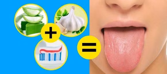 Tai sao luoi cua ban chuyen sang mau trang?-Hinh-2