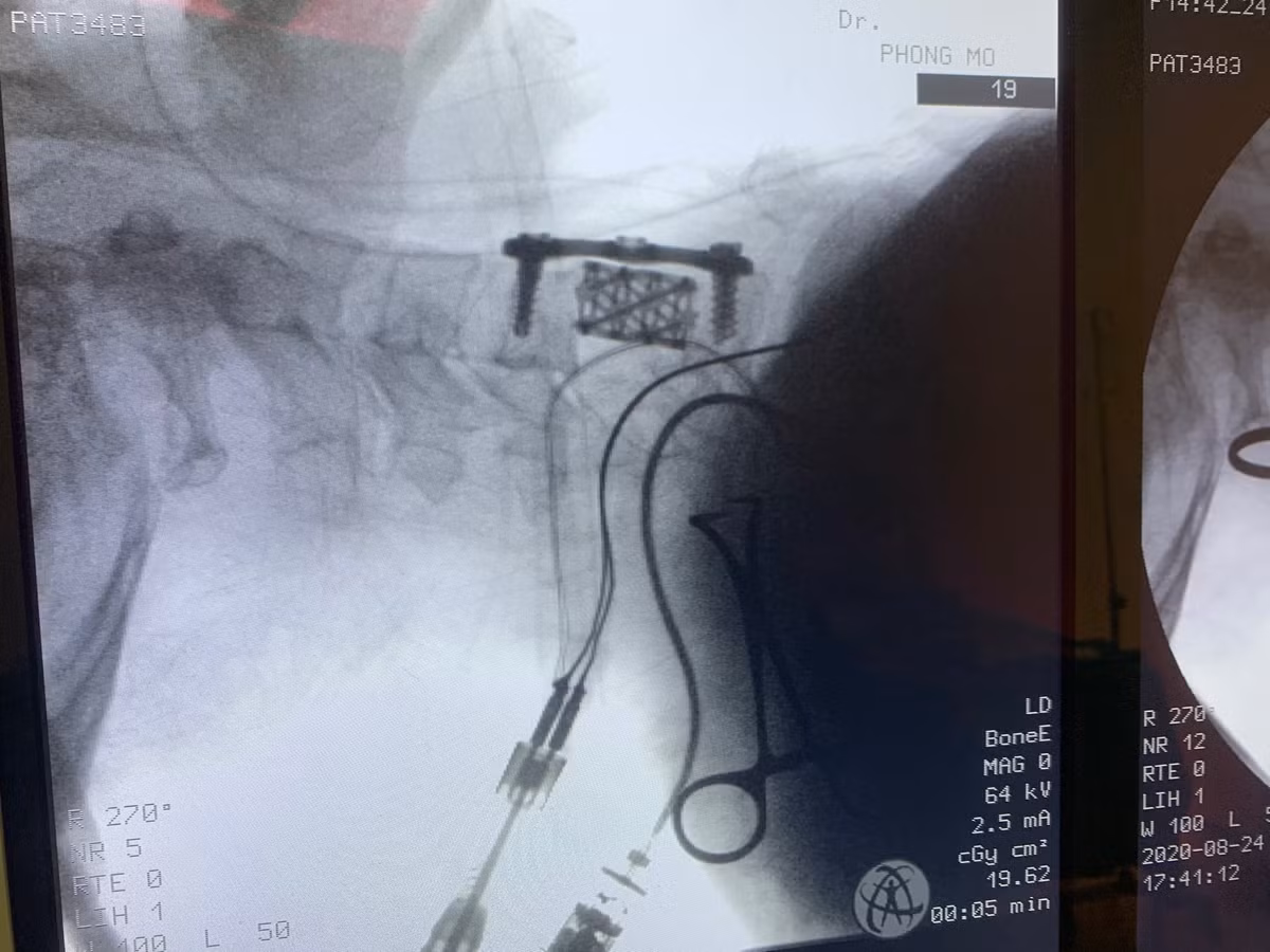 Năm 1959 Viện Radium được sát nhập vào nhà thương Phủ Doãn (Bệnh viện Việt – Đức) và trở thành khoa Ung thư của bệnh viện này trong những năm 1959 – 1969. Từ buổi ban đầu phụ thuộc vào Bệnh viện Việt – Đức về mặt tài chính, các cán bộ y bác sĩ của khoa đã chủ động xây dựng các bộ phận cận lâm sàng mang tính chất độc lập. Ảnh: Benhvienk.vn.