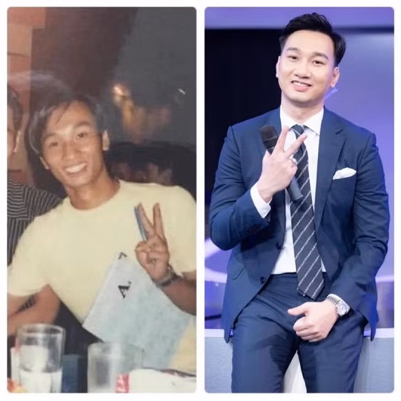 MC Thanh Trung bi soi guong mat qua khac la nghi do 'dao keo'