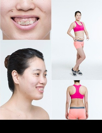 Hàm răng trước đây của Park Dong Hee nhô ra đến 15mm, nước da của cô cũng không đẹp, có nhiều mụn ruồi. Suốt một thời gian dài, Dong Hee bị gắn biệt danh "quái vật", bị trêu chọc, bị hành hạ về mặt tinh thần chỉ vì kém may mắn có được thân hình kém sắc. Và sau khi xem một chương trình thực tế về làm đẹp, cô gái đã quyết tâm thay đổi, làm một cuộc "đại tu" cho chính mình.