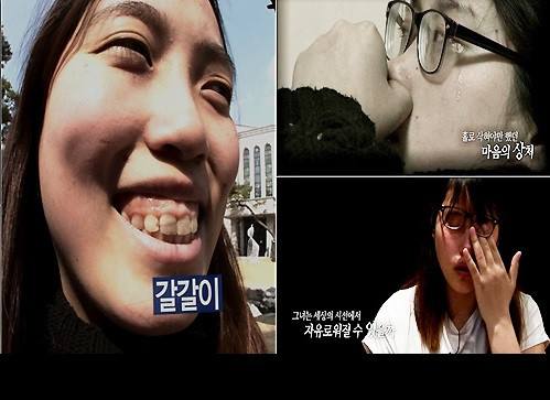 Cách đây không lâu, Park Dong Hee là một cô gái có ngoại hình khá xấu xí. Cả thân hình và gương mặt của Dong Hee đều không gọn gàng, đôi mắt híp tịt cùng với hàm răng xỉn màu, lồi xỉ... Cô gái trẻ từng có những tháng ngày chẳng khác nào như sống dưới địa ngục do quá tự ti, đau khổ về ngoại hình của mình.