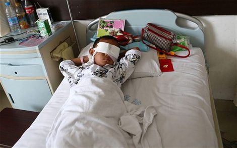 Bé trai Guo Bin đang điều trị tại bệnh viện. Bé trai Guo Bin đang điều trị tại bệnh viện.