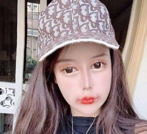 Nu streamer trai qua 100 lan “dao keo” den me ruot cung chang nhan ra-Hinh-4