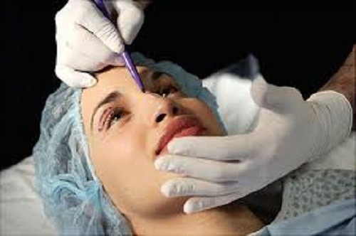 Việc đưa thêm các “vật thể lạ” có thể khiến cho mũi gặp phải các biến chứng như mũi lệch, méo mó... Thậm chí, việc cấy mỡ hay tiêm filler còn có thể gây ảnh hưởng đến cả khuôn mặt, dẫn đến tình trạng mặt sưng phồng, biến dạng.