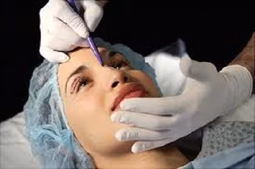 Việc đưa thêm các “vật thể lạ” có thể khiến cho mũi gặp phải các biến chứng như mũi lệch, méo mó... Thậm chí, việc cấy mỡ hay tiêm filler còn có thể gây ảnh hưởng đến cả khuôn mặt, dẫn đến tình trạng mặt sưng phồng, biến dạng.