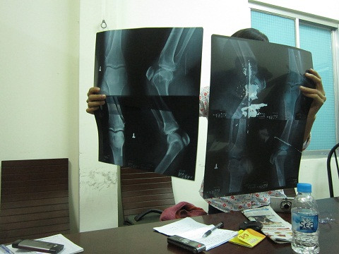 Vụ ăn bớt phim chấn động ngành y TP.HCM bị một bác sĩ tố cáo