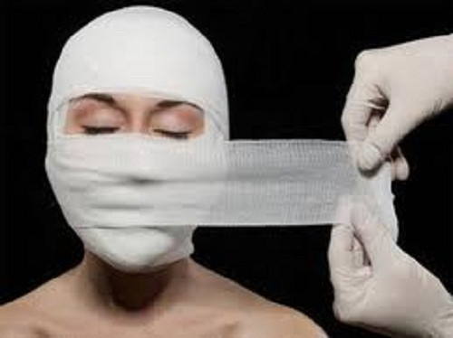 Gọt mặt: Hiện nay phẫu thuật gọt mặt rất phổ biến và được nhiều chị em sử dụng để có khuôn mặt thon gọn, thanh thoát hơn. Đây là loại phẫu thuật phức tạp, sâu rộng và có tính chuyên môn cao, đòi hỏi bác sĩ phải can thiệp không chỉ khu trú ở mô mềm mà tác động sâu vào cấu trúc trong xương nâng đỡ bên dưới, cấu trúc sọ mặt.