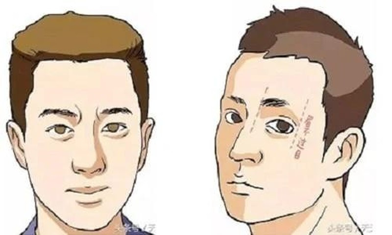 Những người đàn ông có nét tướng này cuộc sống mãi nghèo khổ, vất vả. Lông mày mọc ngược là người đàn ông có tâm địa độc ác, bạo lực, ngang ngược.