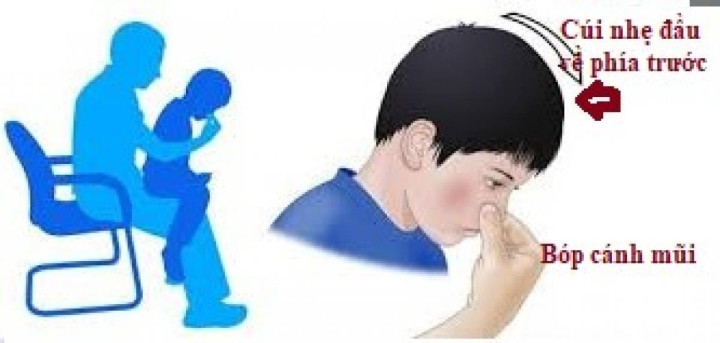 Tại sao trẻ hay bị chảy máu cam vào mùa đông? - Hình 2 Tai sao tre hay bi chay mau cam vao mua dong?-Hinh-2