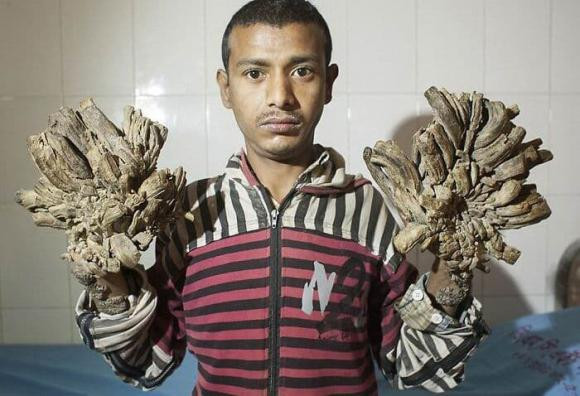 20 buc anh khien chung ta 