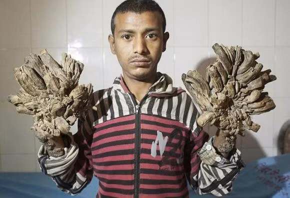 20 buc anh khien chung ta 