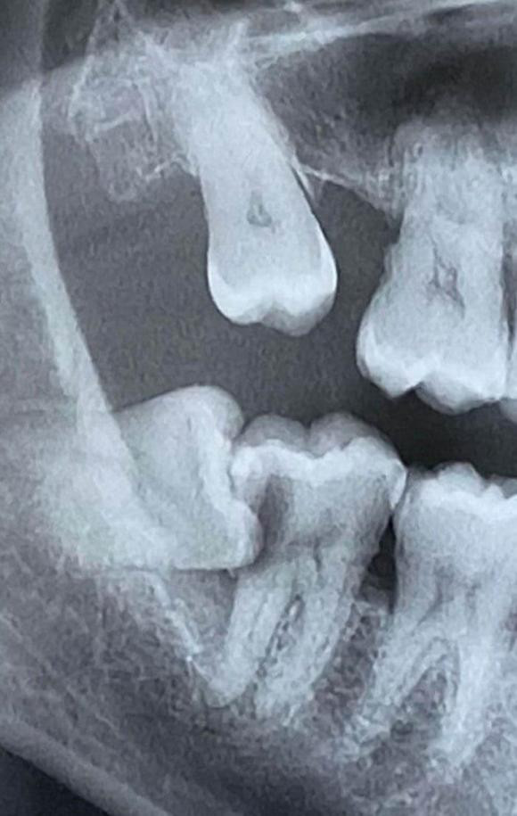 20 buc anh khien chung ta 