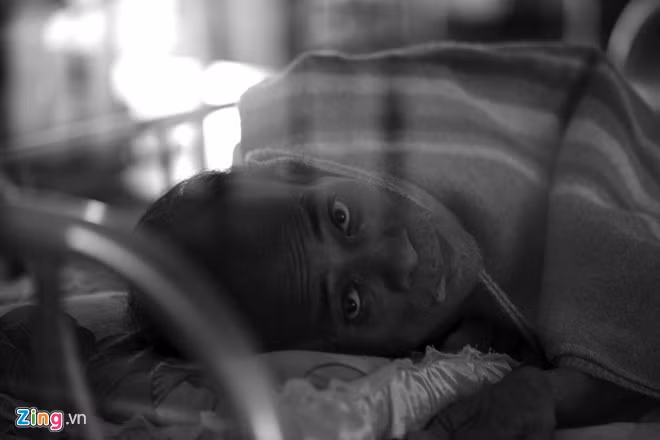 Ánh mắt thẫn thờ của bệnh nhân lớn tuổi đã nằm trong bệnh viện mấy năm nay chưa được một lần người nhà vào thăm.