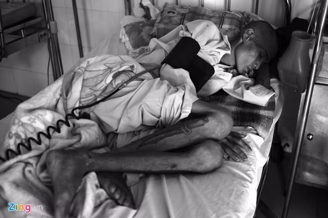 Người đàn ông này này có một quá khứ yêng hùng. Còn giờ đây, thế giới của anh ta chỉ bó hẹp trên chiếc giường cùng nỗi đau đớn của bệnh tật.