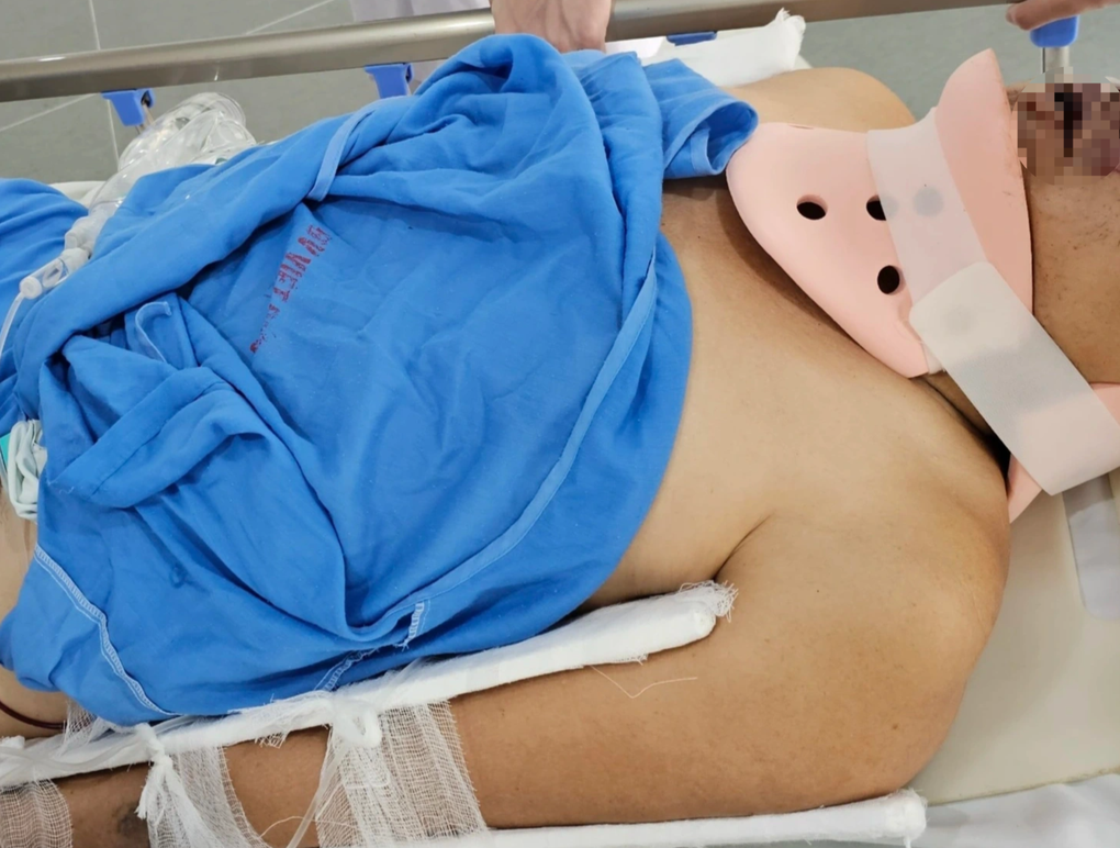 Vụ tai nạn 5 người chết: Tôi mở mắt ra thấy người bị thương nằm la liệt - 3