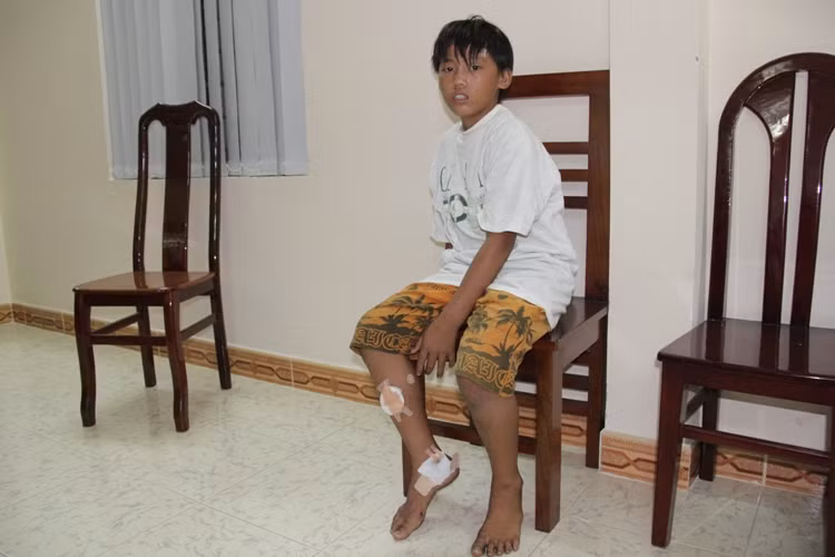 Thương tích trên người và vẻ hoảng loạn trên gương mặt cháu trai 13 tuổi sớm cùng cha mưu sinh trên biển/