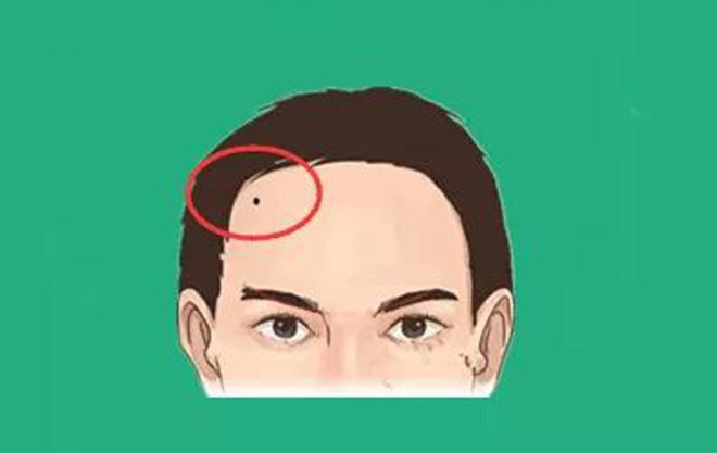 Tuy nhiên, nếu nó mọc gần Cung Quan Lộc ở hai bên trái và phải, đó là nốt ruồi hiếm gặp và tốt lành, khi đến thời điểm, bạn nhất định sẽ giàu có! 