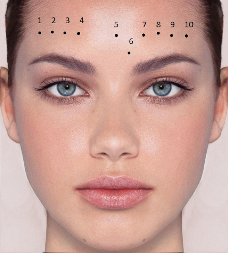 Nốt ruồi ở trán. Trán hay còn gọi là Thiên đình, là nơi có cung Phúc lộc trên cơ thể con người, nếu nốt ruồi này mọc ở giữa trán là người có tính cách tương đối kiêu ngạo, dễ xung đột với người khác, tình cảm vợ chồng dễ xảy ra bất đồng.