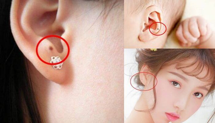  Sự xuất hiện của đôi tai rất đặc biệt. Vận số của một người có tốt hay không đều liên quan mật thiết đến đôi tai. Ngoài ra, mỗi chúng ta đều có những nốt ruồi lớn nhỏ khác nhau. Những nốt ruồi trên tai có ý nghĩa rất đặc biệt.