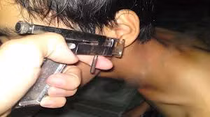 Dụng cụ bấm lỗ tai, nong tai không đảm bảo tiệt trùng có thể gây nhiều bệnh nguy hiểm