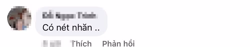 Loạt bình luận của dân mạng. Ở tuổi ngoài 40 trở đi, lão hóa là điều không thể tránh khỏi. Hai vấn đề chính mà phụ nữ ở độ tuổi này thường gặp phải là da nhăn và chảy xệ vì thiếu độ đàn hồi. Việc chăm sóc đúng cách và các liệu pháp chống lão hóa tiên tiến cũng chỉ có thể cải thiện phần nào.