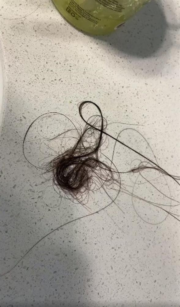 áng chú ý, trong quá trình điều trị, Đỗ Thị Hà gặp phải triệu chứng rụng tóc nhiều hơn hẳn bình thường, tuy nhiên điều này không ảnh hưởng nhiều đến tâm lý của nàng hậu. Cô tin sau khi hồi phục thì tóc sẽ trở lại trạng thái bình thường.