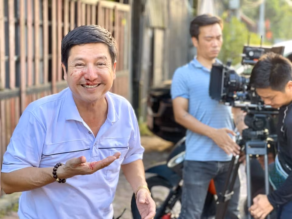 Nghệ sĩ Chí Trung chia sẻ ảnh bị chảy máu mũi tại hậu trường phim.