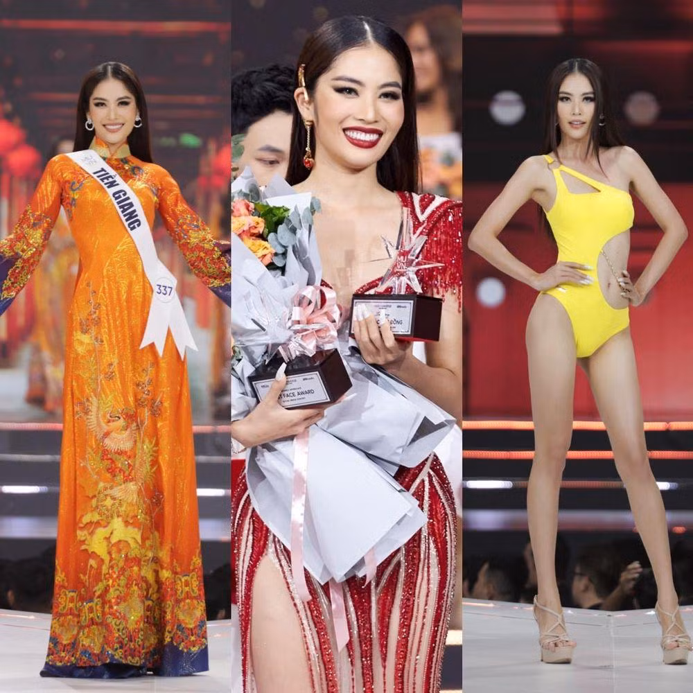 Le Nam nhap vien cap cuu giua dem, suc khoe gio the nao?-Hinh-3