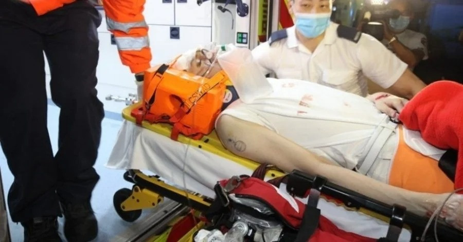 Còn A Mo, do bị màn hình LED rơi trúng nên thương tích rất nghiêm trọng. Nam vũ công tổn thương nặng vùng cột sống và xương chậu. Anh đang phải nằm trong phòng chăm sóc đặc biệt dù vẫn tỉnh táo. Theo HK01, A Mo trải qua ca phẫu thuật kéo dài 7-8 tiếng. Nam vũ công đối diện nguy cơ bị liệt nửa người. Cha mẹ anh đang thu xếp từ Canada về Hong Kong.