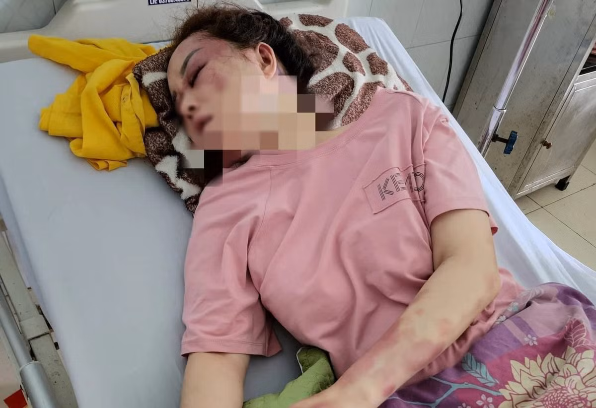 Co gai to bi ban trai danh, lot quan ao vi song ca voi nguoi khac