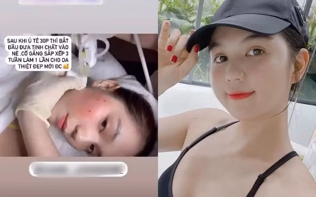 Để giữ gìn làn da ở tuổi ngoài 30 như hiện tại, Ngọc Trinh cũng nhờ cậy phương pháp tiêm tinh chất. Phương pháp này sẽ giúp da cải thiện rất nhiều trong 1 lần tiêm, trong tinh chất được đưa vào da có tất cả hoạt chất cần thiết như: Vitamin, khoáng chất, Tế bào gốc... cấy thẳng vào lớp trung bì của da, việc tiêm này giúp thẩm thấu được tất cả các dưỡng chất để nuôi lớp da bên trên 1 cách nhanh chóng mà không làm tổn thương bề mặt.