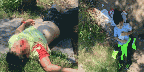 Lam Chi Dinh the nao sau ca phau thuat keo dai gan 5 tieng?-Hinh-2