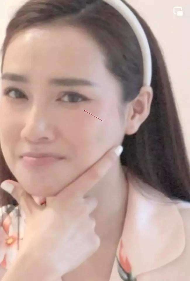 hã Phương từng thừa nhận nếp nhăn, bọng mắt là khuyết điểm khiến cô tự ti nhất trong một lần livestream.