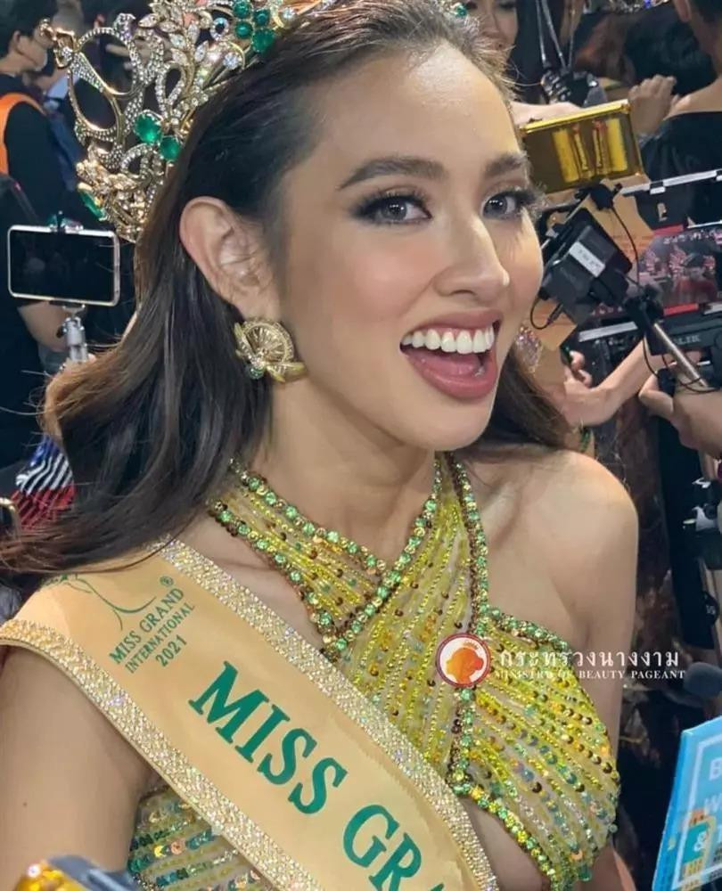 Sau khi đăng quang Miss Grand International 2022, cô cũng thẳng thắn chia sẻ cô đã niềng và cắt nướu để nụ cười đẹp hơn, còn răng vẫn là răng thật. "Cái răng cái tóc là góc con người", thế mới thấy chị em chỉ cần sở hữu hàm răng chuẩn đẹp là nhan sắc đã có thể thay đổi gần như hoàn toàn.