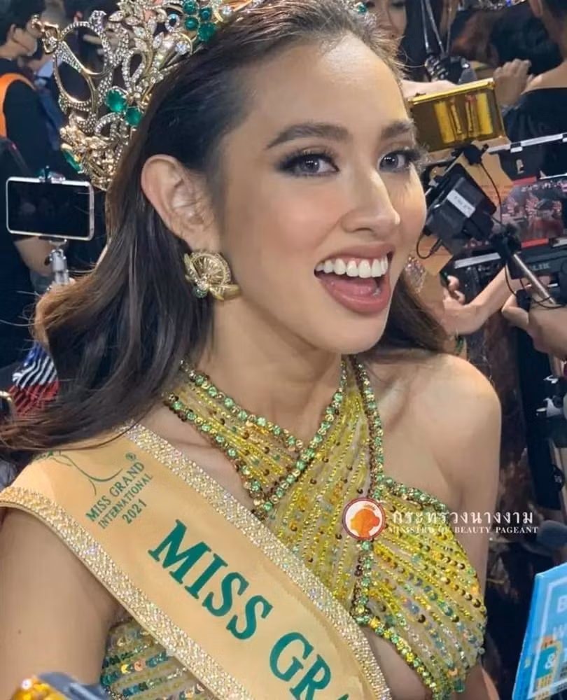 Sau khi đăng quang Miss Grand International 2022, cô cũng thẳng thắn chia sẻ cô đã niềng và cắt nướu để nụ cười đẹp hơn, còn răng vẫn là răng thật. "Cái răng cái tóc là góc con người", thế mới thấy chị em chỉ cần sở hữu hàm răng chuẩn đẹp là nhan sắc đã có thể thay đổi gần như hoàn toàn.