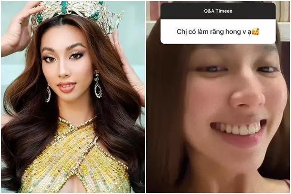 ác đường nét trên gương mặt của Thùy Tiên không còn mộc mạc như xưa mà đã có điểm nhấn thu hút hơn nhờ niềng răng.