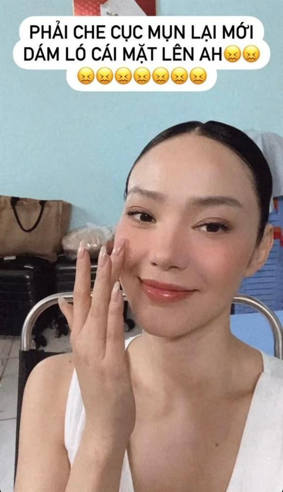 à xã doanh nhân Quốc Bảo phải tạm thời che bằng mỹ phẩm để tiếp tục với núi công việc.