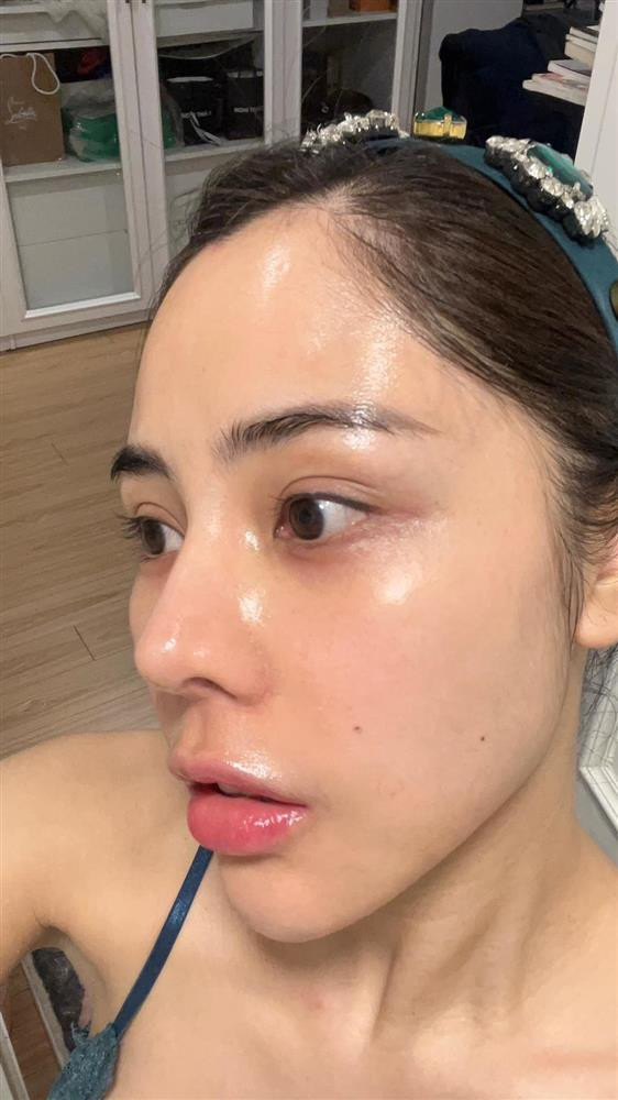 Người đẹp cũng thường xuyên chụp ảnh cận mặt để chứng minh không thẩm mỹ. Khi là người của công chúng, những nghệ sĩ thường xuyên phải nâng cấp, thay đổi vẻ ngoài. Tuy nhiên, những màn lột xác bất ngờ của họ khiến netizen đặt ra nghi vấn về vấn đề phẫu thuật thẩm mỹ. Để chứng minh bản thân không "dao kéo", nhiều người đẹp đã chi tiền thưởng khủng cho người phát hiện ra dấu hiệu "trùng tu" của mình.