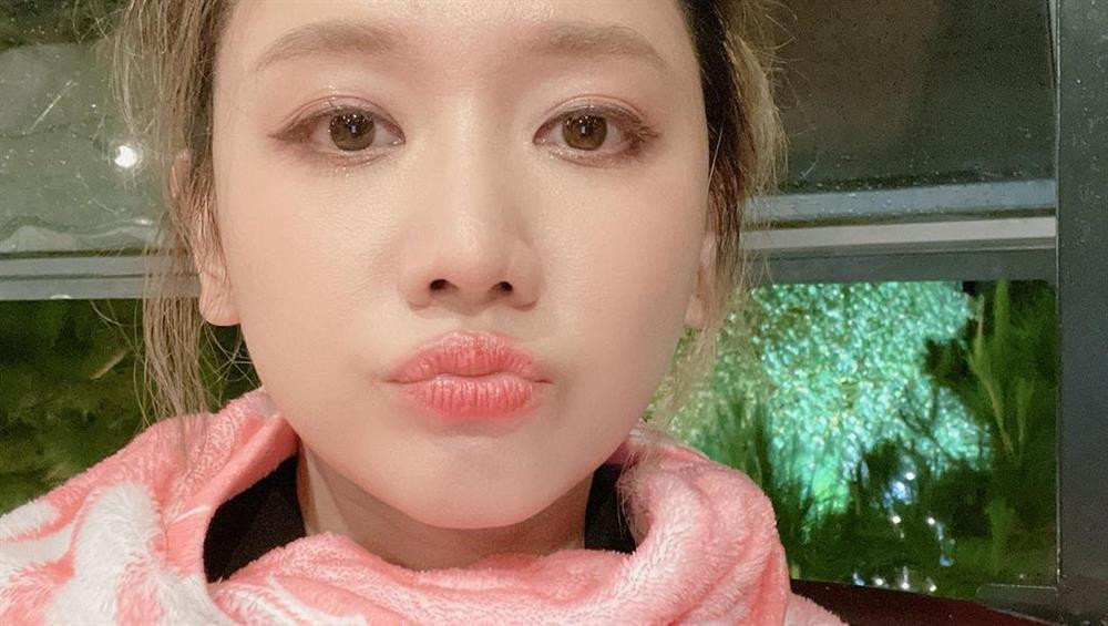 ó cũng là lý do cô vẫn chạy show như bình thường dù đang liệt nửa mặt.