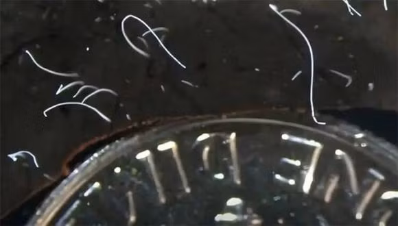 Bi an ve vi khuan lon nhat lich su, dai toi 2 cm-Hinh-2