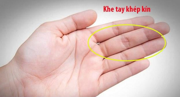  Nên những người này hứa hẹn số mệnh giàu sang phú quý an lành. Những người có lòng bàn tay mà ngón tay sát nhau không nhiều kẽ hở chứng tỏ họ là người có tương lai phú quý, biết nắm bắt cơ hội trong cuộc đời, biết làm giàu và biết giữ tiền. 