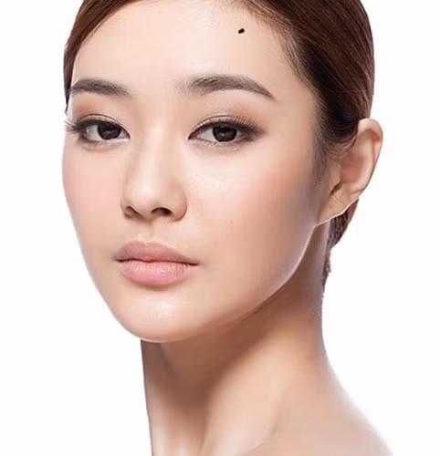 Doan tinh duyen qua vi tri not ruoi tren mat