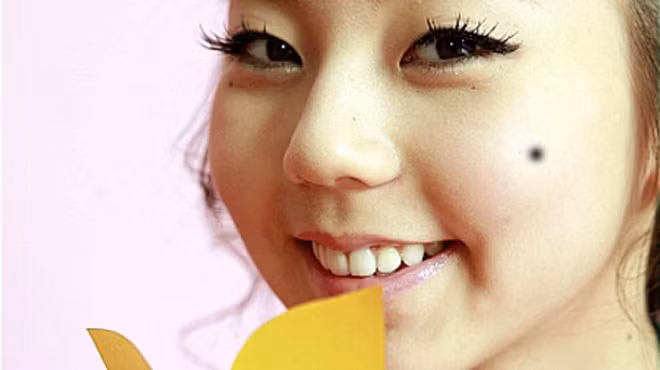 Nốt ruồi ờ hai bên gò má: Người có đặc điểm này chuyện tình cảm rất dễ xảy ra vấn đề, có thể là chuyện tình yêu tay ba.