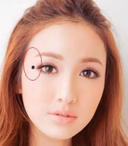 Nốt ruồi ở cung phu thê. Điều này có thể ảnh hưởng đến tình cảm lứa đôi, rất khó có nhân duyên tốt, rất dễ vì nguyên nhân từ một phía mà làm hỏng chuyện tình duyên của lứa đôi. Những người này nên chú tâm vào tình cảm.