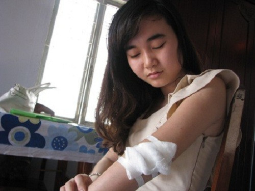 Mỹ Anh cho biết, ngoài thương tích ngoài da hiện cô bị tức ngực, ăn uống khó khăn.