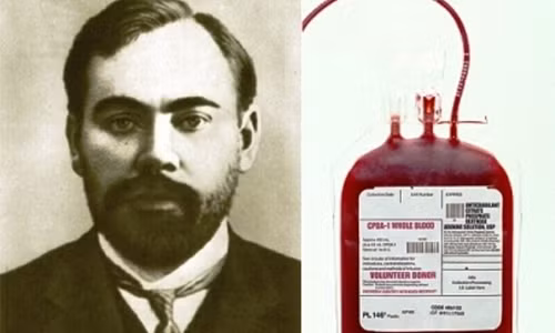 Ông Alexander đã 11 lần truyền máu vào chính cơ thể mình. Tuy nhiên, trong lần truyền máu cuối cùng, ông đã bị nhiễm sốt rét và lao rồi tử vong sau đó.